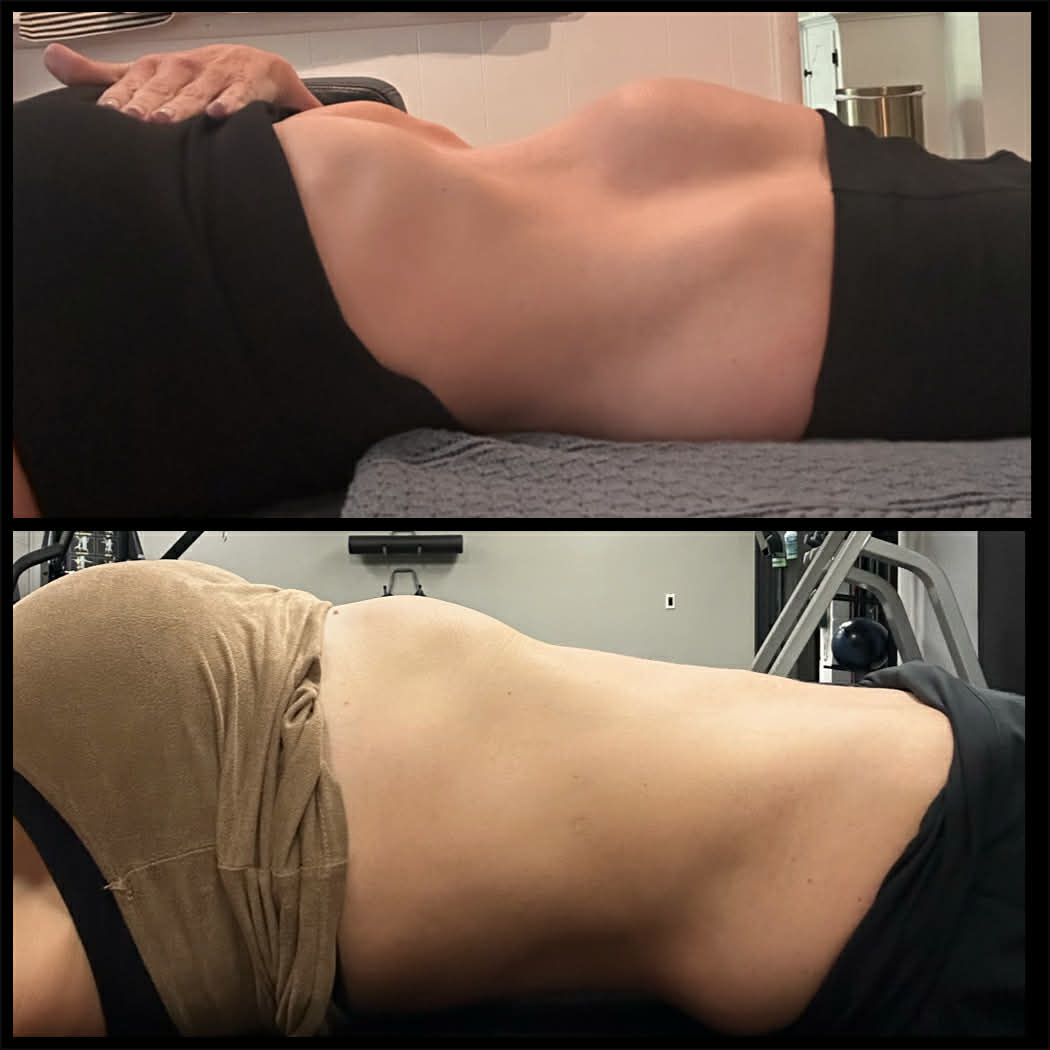 Before and after — the lump disappeared within 90 minutes of deep emotional processing